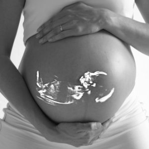 ultrasound pregnant belly
